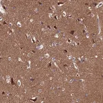 Atlas Antibodies Anti-PPP2R2B Antibody