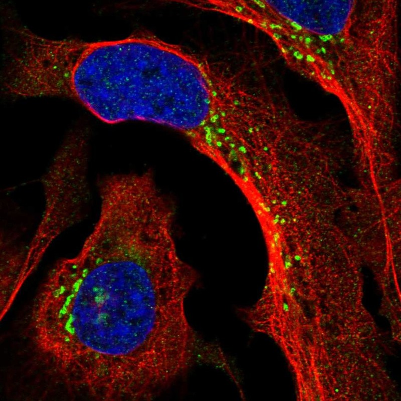 Atlas Antibodies Anti-PPP2R3A Antibody
