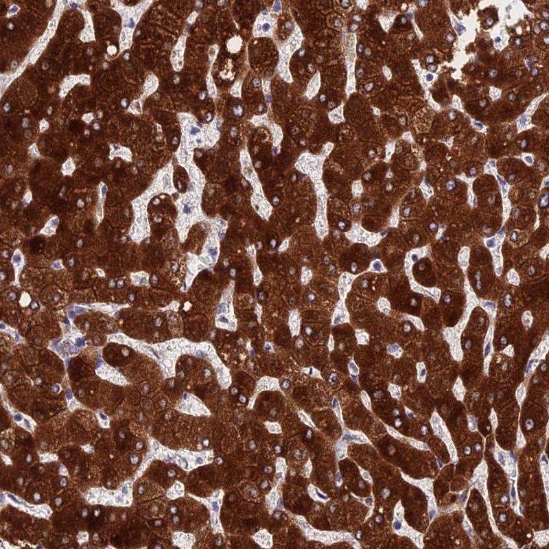 Atlas Antibodies Anti-PPP2R2D Antibody