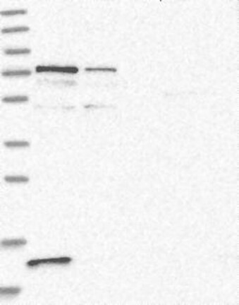 Atlas Antibodies Anti-PPP2R3B Antibody