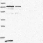 Atlas Antibodies Anti-PPP2R3B Antibody