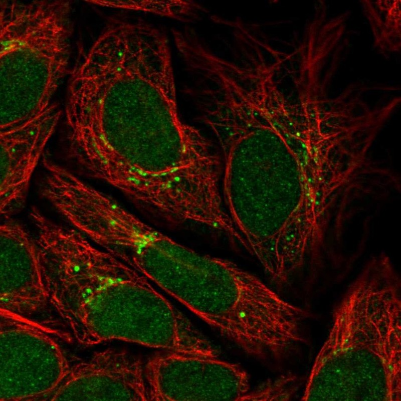 Atlas Antibodies Anti-PPP2R3C Antibody