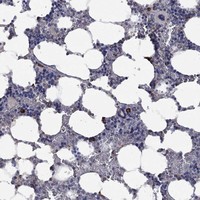 Atlas Antibodies Anti-PPP2R5A Antibody