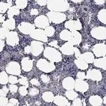 Atlas Antibodies Anti-PPP2R5A Antibody