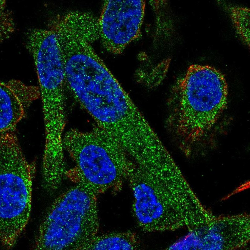 Atlas Antibodies Anti-PPP2R5A Antibody