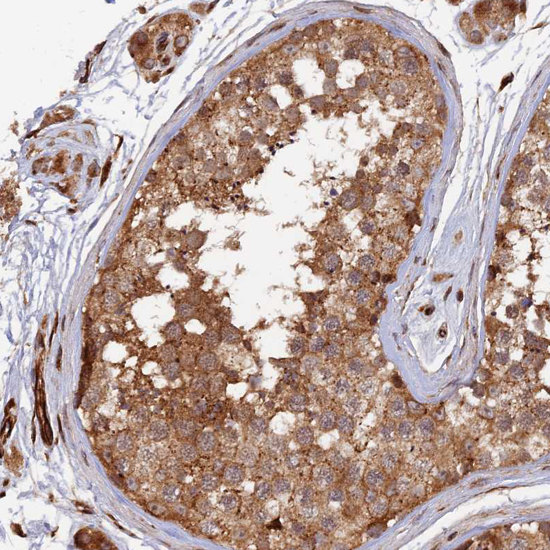 Atlas Antibodies Anti-PPP2R3C Antibody