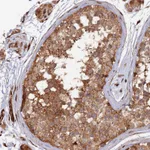 Atlas Antibodies Anti-PPP2R3C Antibody