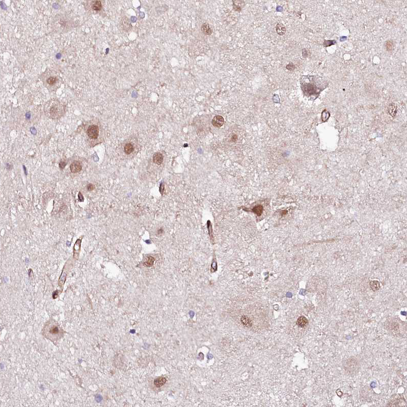 Atlas Antibodies Anti-PPP2R5B Antibody