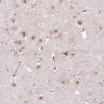 Atlas Antibodies Anti-PPP2R5B Antibody