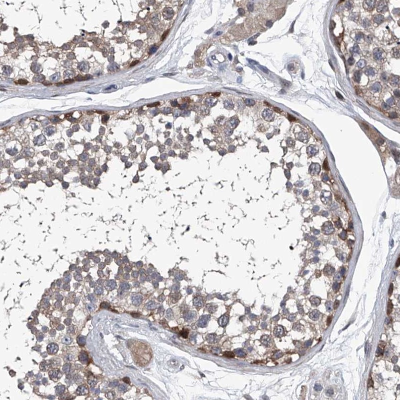Atlas Antibodies Anti-PPP2R5D Antibody