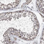 Atlas Antibodies Anti-PPP2R5D Antibody