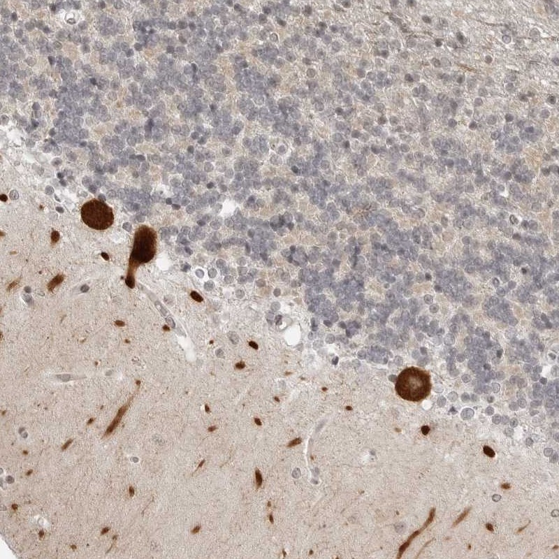 Atlas Antibodies Anti-PPP2R5C Antibody