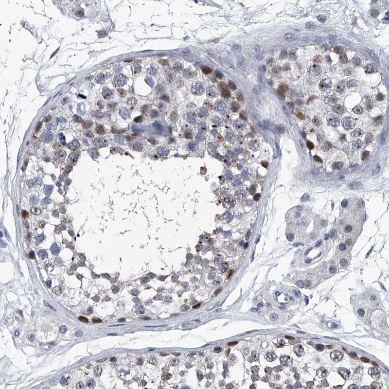Atlas Antibodies Anti-PPP2R5D Antibody