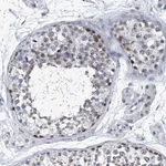 Atlas Antibodies Anti-PPP2R5D Antibody