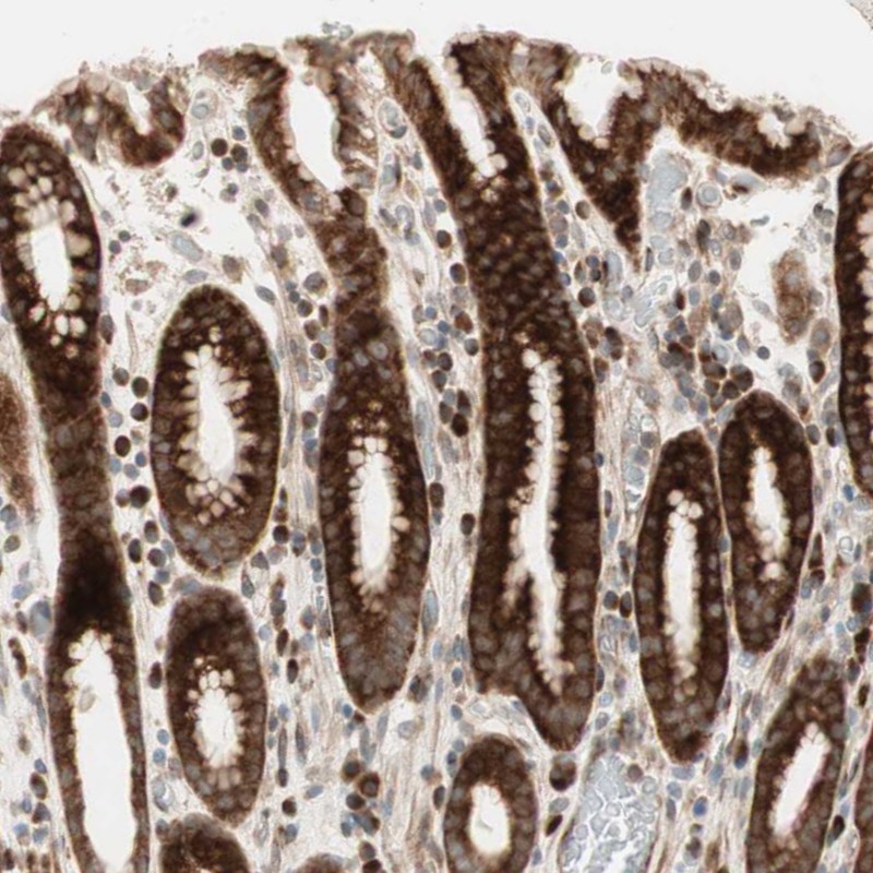 Atlas Antibodies Anti-PPP2R5E Antibody