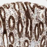 Atlas Antibodies Anti-PPP2R5E Antibody