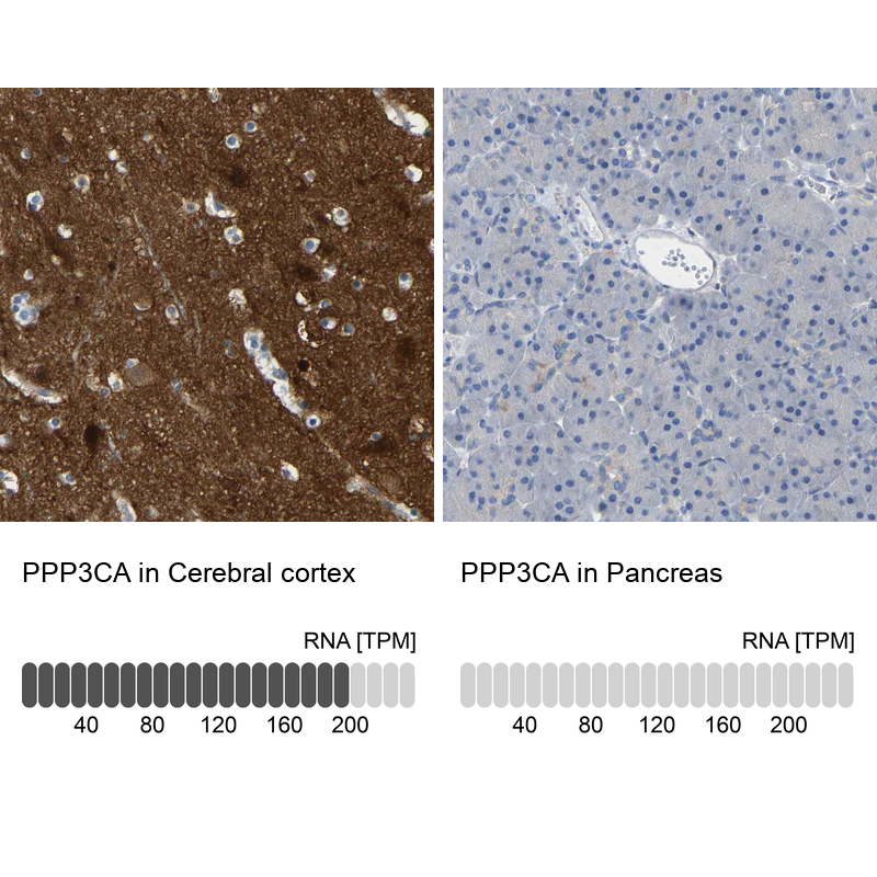 Atlas Antibodies Anti-PPP3CA Antibody