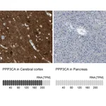 Atlas Antibodies Anti-PPP3CA Antibody