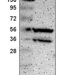 Atlas Antibodies Anti-PPP3CB Antibody
