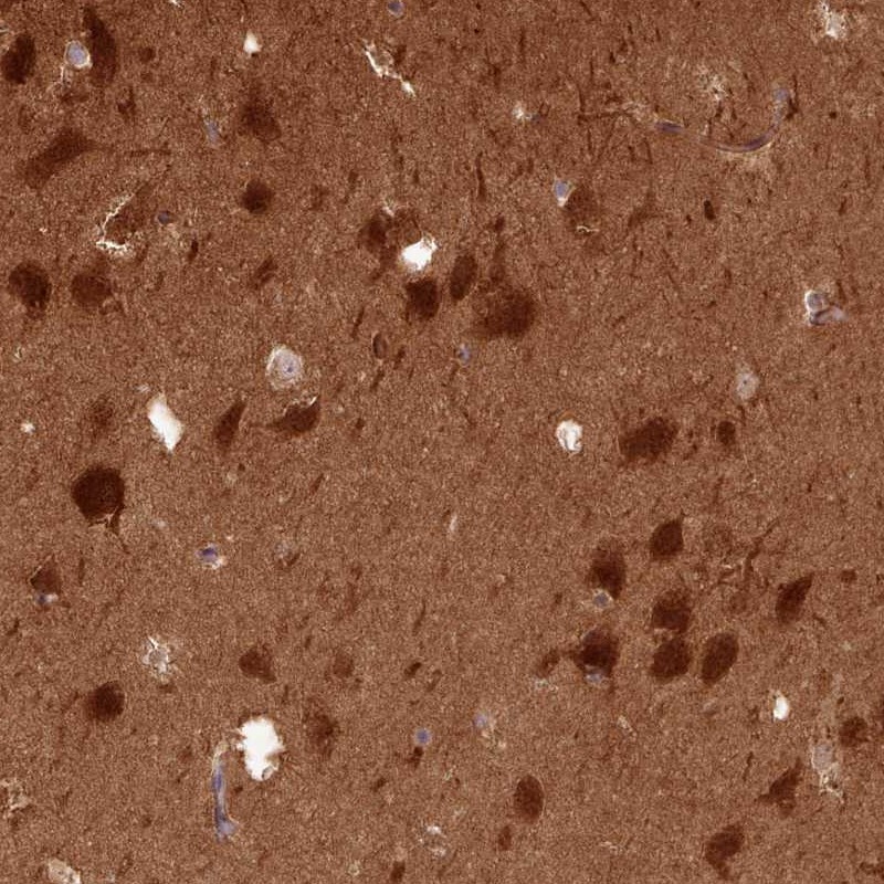Atlas Antibodies Anti-PPP3R1 Antibody