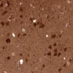 Atlas Antibodies Anti-PPP3R1 Antibody