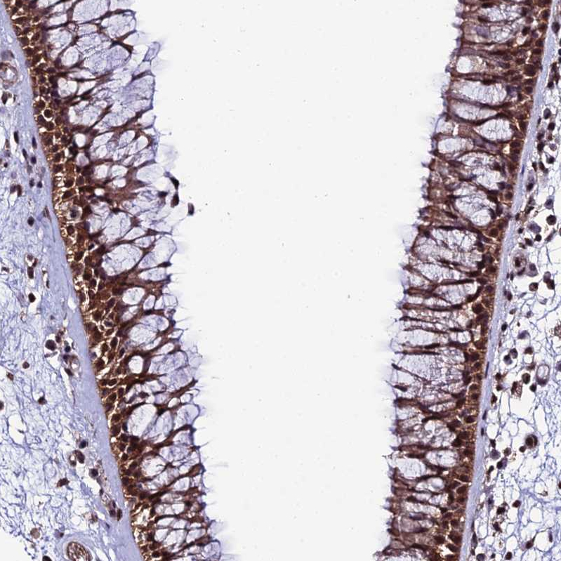 Atlas Antibodies Anti-PPP4C Antibody