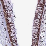 Atlas Antibodies Anti-PPP4C Antibody