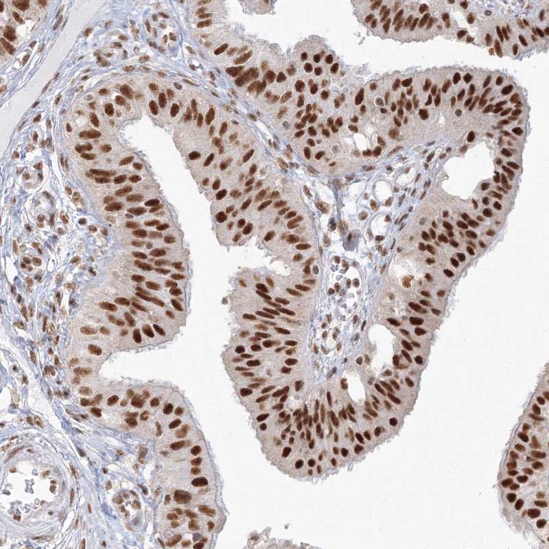 Atlas Antibodies Anti-PPP4R2 Antibody