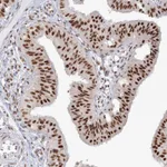 Atlas Antibodies Anti-PPP4R2 Antibody