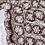 Atlas Antibodies Anti-PPP4R1 Antibody