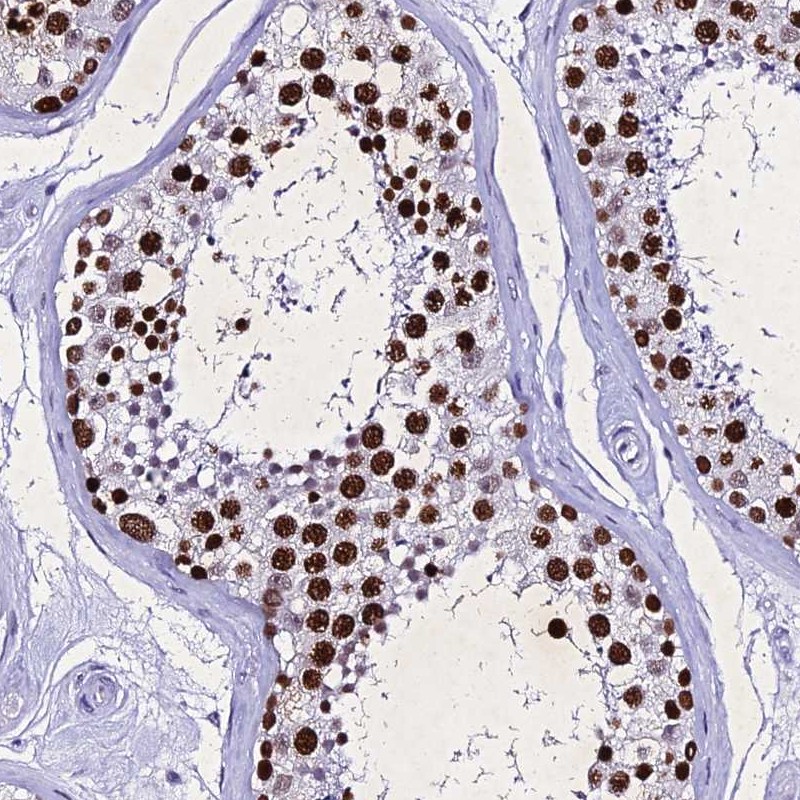 Atlas Antibodies Anti-PPP4R2 Antibody