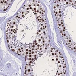 Atlas Antibodies Anti-PPP4R2 Antibody