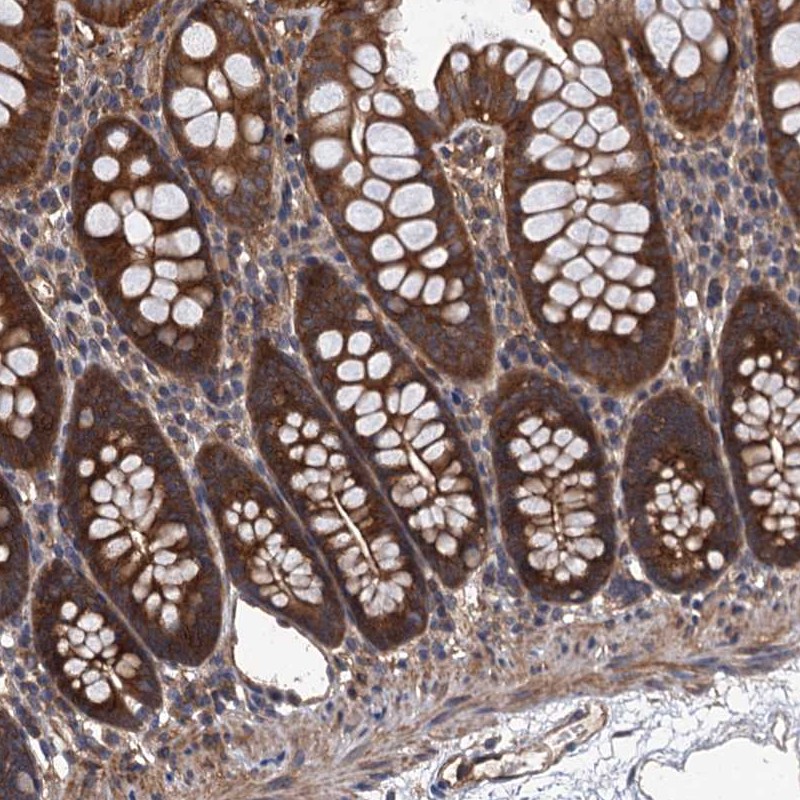 Atlas Antibodies Anti-PPP4R1 Antibody