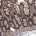 Atlas Antibodies Anti-PPP4R1 Antibody