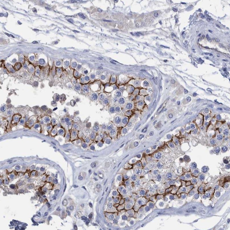 Atlas Antibodies Anti-PPP3CC Antibody