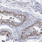Atlas Antibodies Anti-PPP3CC Antibody