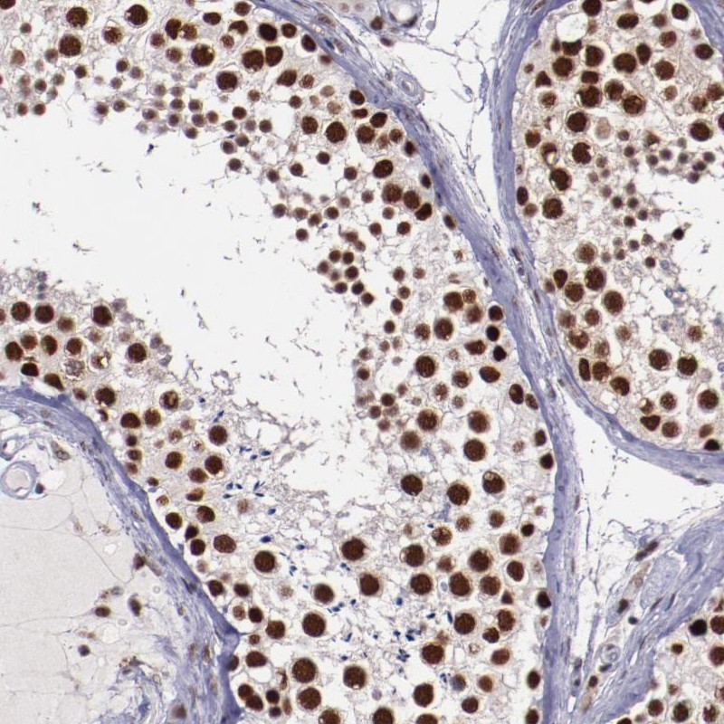 Atlas Antibodies Anti-PPP4R3A Antibody