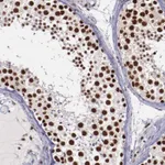 Atlas Antibodies Anti-PPP4R3A Antibody