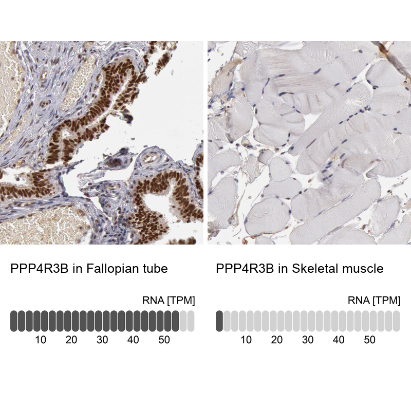 Atlas Antibodies Anti-PPP4R3B Antibody