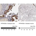 Atlas Antibodies Anti-PPP4R3B Antibody
