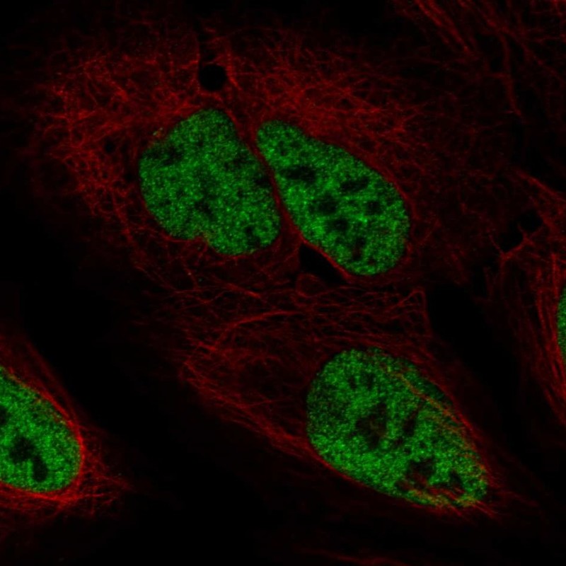Atlas Antibodies Anti-PPP4R2 Antibody