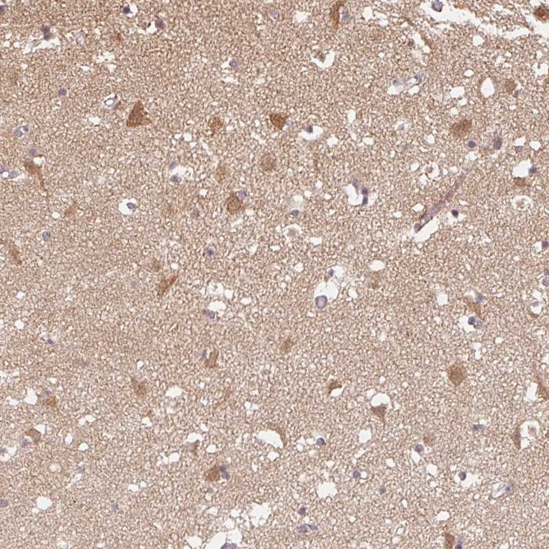 Atlas Antibodies Anti-PPP4R4 Antibody