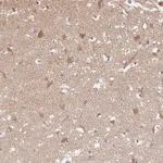 Atlas Antibodies Anti-PPP4R4 Antibody