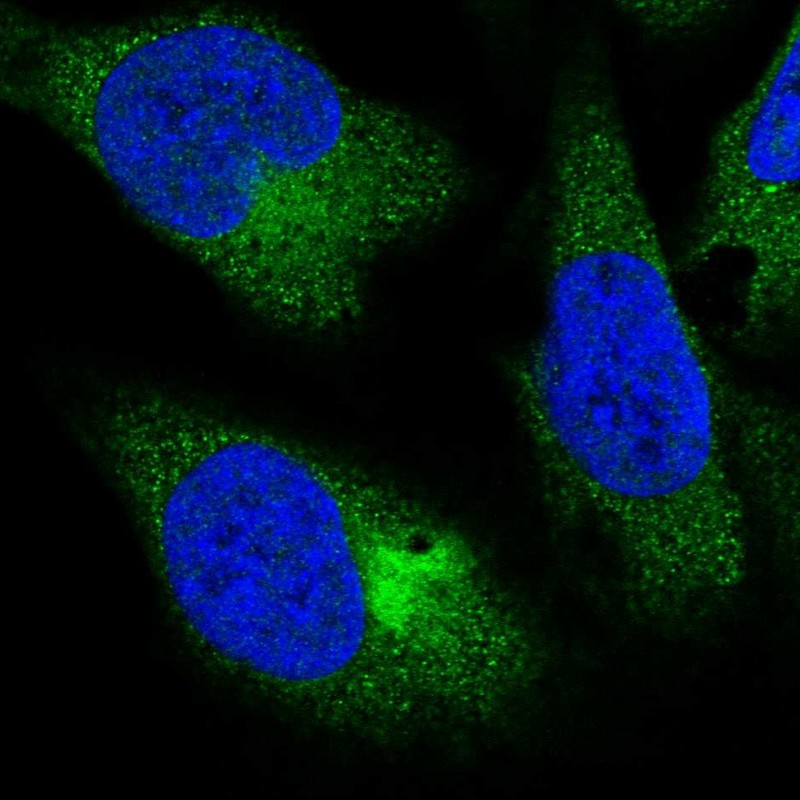Atlas Antibodies Anti-PPP4R4 Antibody
