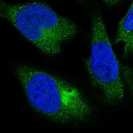Atlas Antibodies Anti-PPP4R4 Antibody