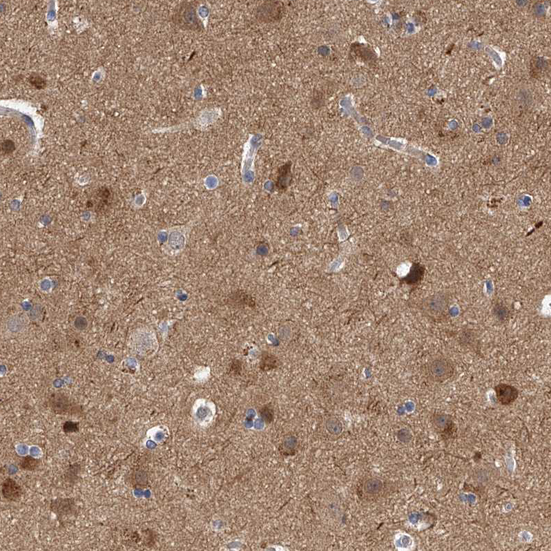 Atlas Antibodies Anti-PPP5C Antibody