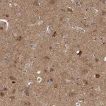 Atlas Antibodies Anti-PPP5C Antibody