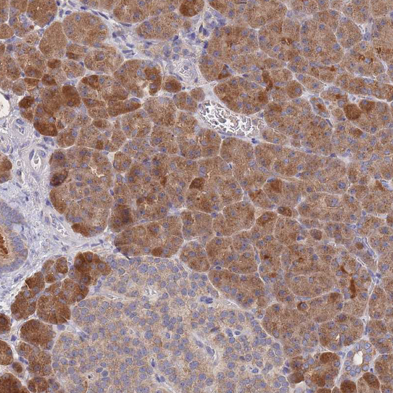 Atlas Antibodies Anti-PPP6C Antibody