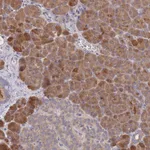 Atlas Antibodies Anti-PPP6C Antibody