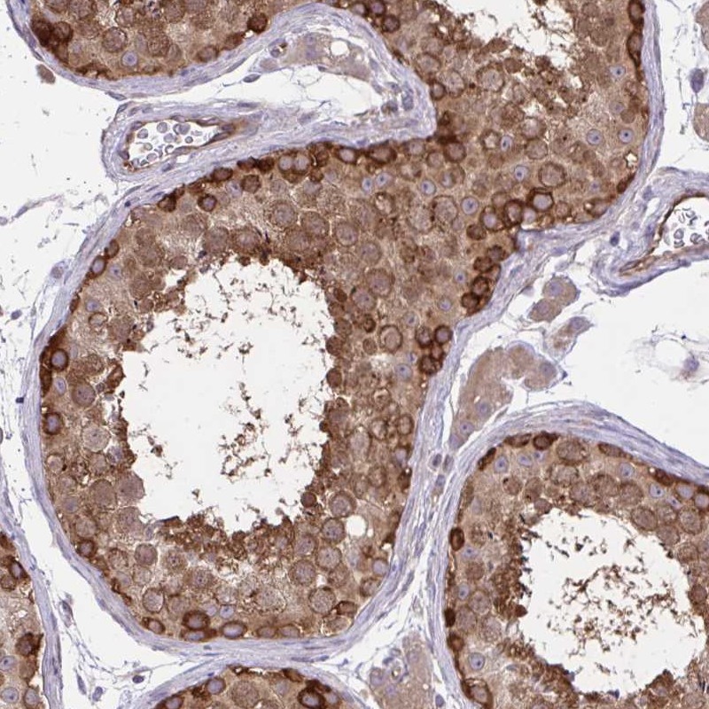 Atlas Antibodies Anti-PPP5C Antibody